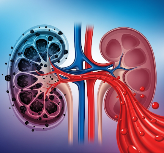 Creatinine  test